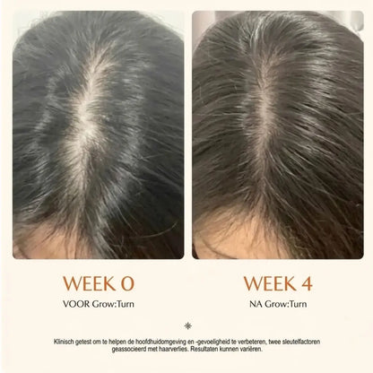 Selyven Exosoom Haar-groei Serum met Hoofdhuid Massageborstel