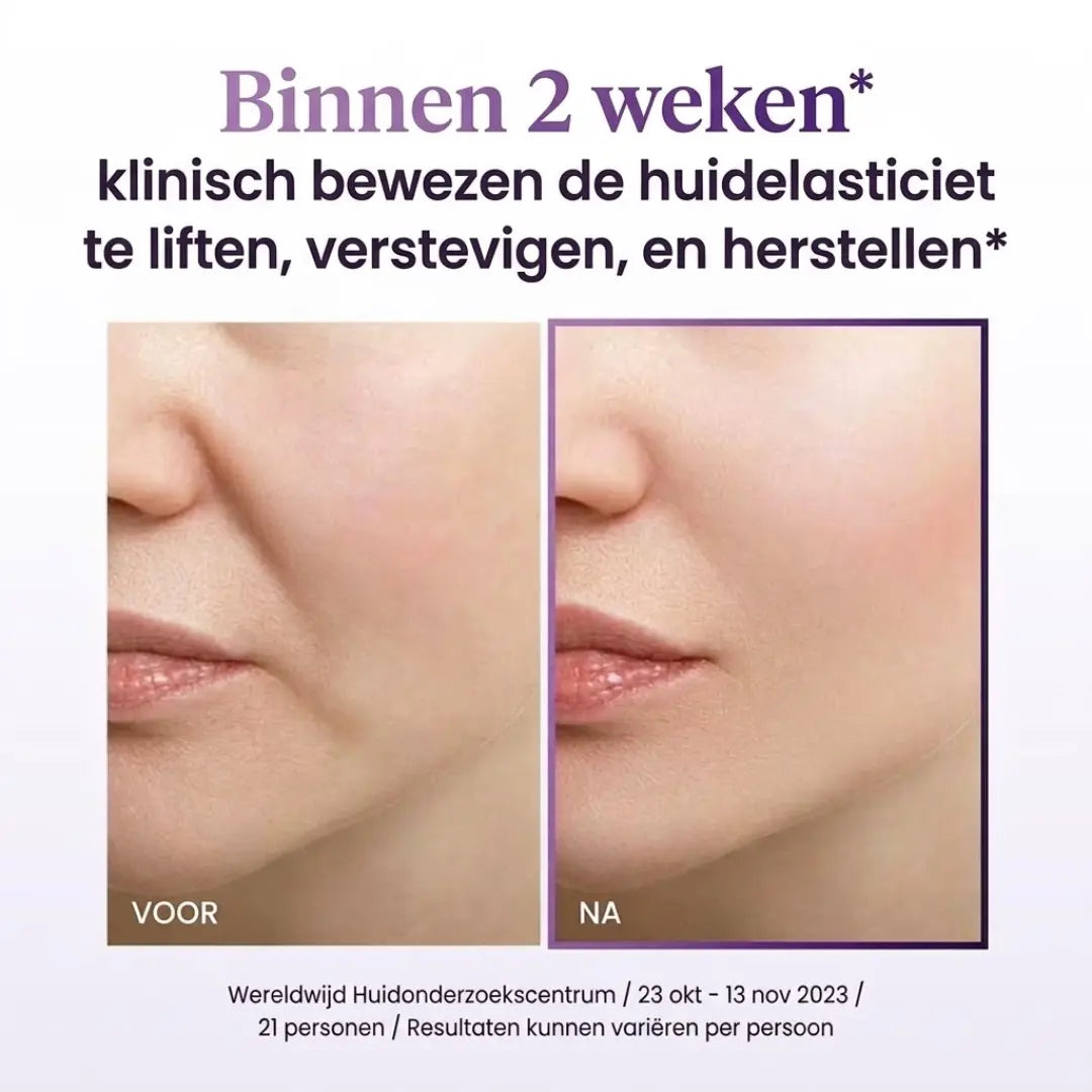 SELYVEN™ Lift Cream - Stevigmakende & Anti-Rimpel Nachtcrème